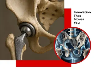 Hip Replacement Surgery Hospital Nagpur