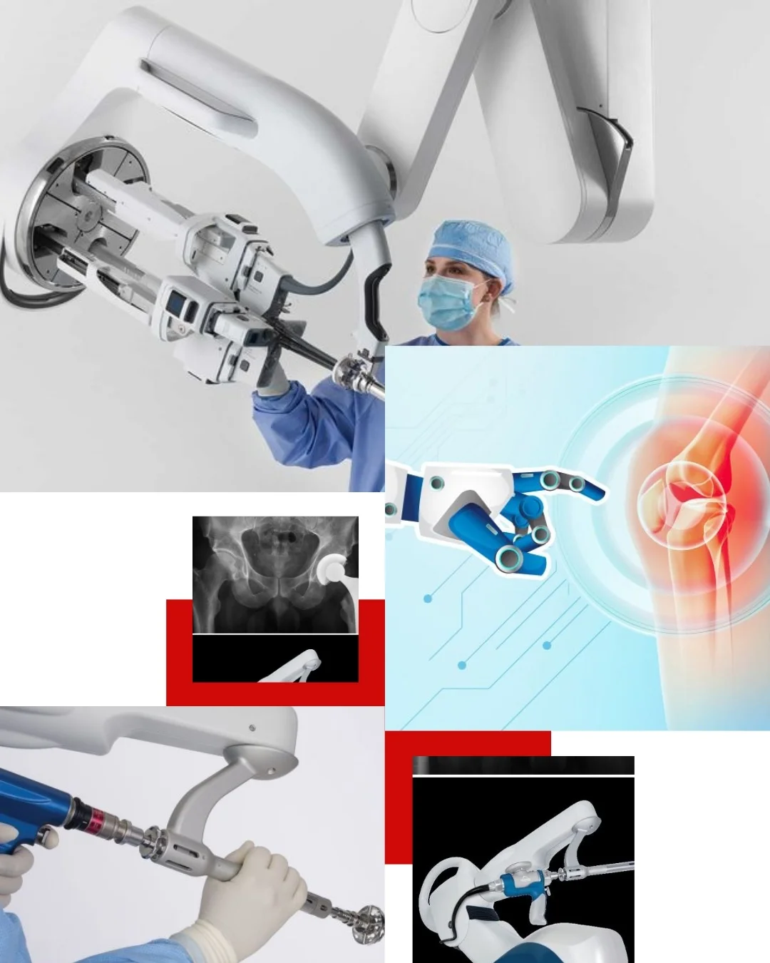 Robotic-Assisted Joint Replacement Surgery in Nagpur — Dr. Rahul Agrawal - RK Hospital