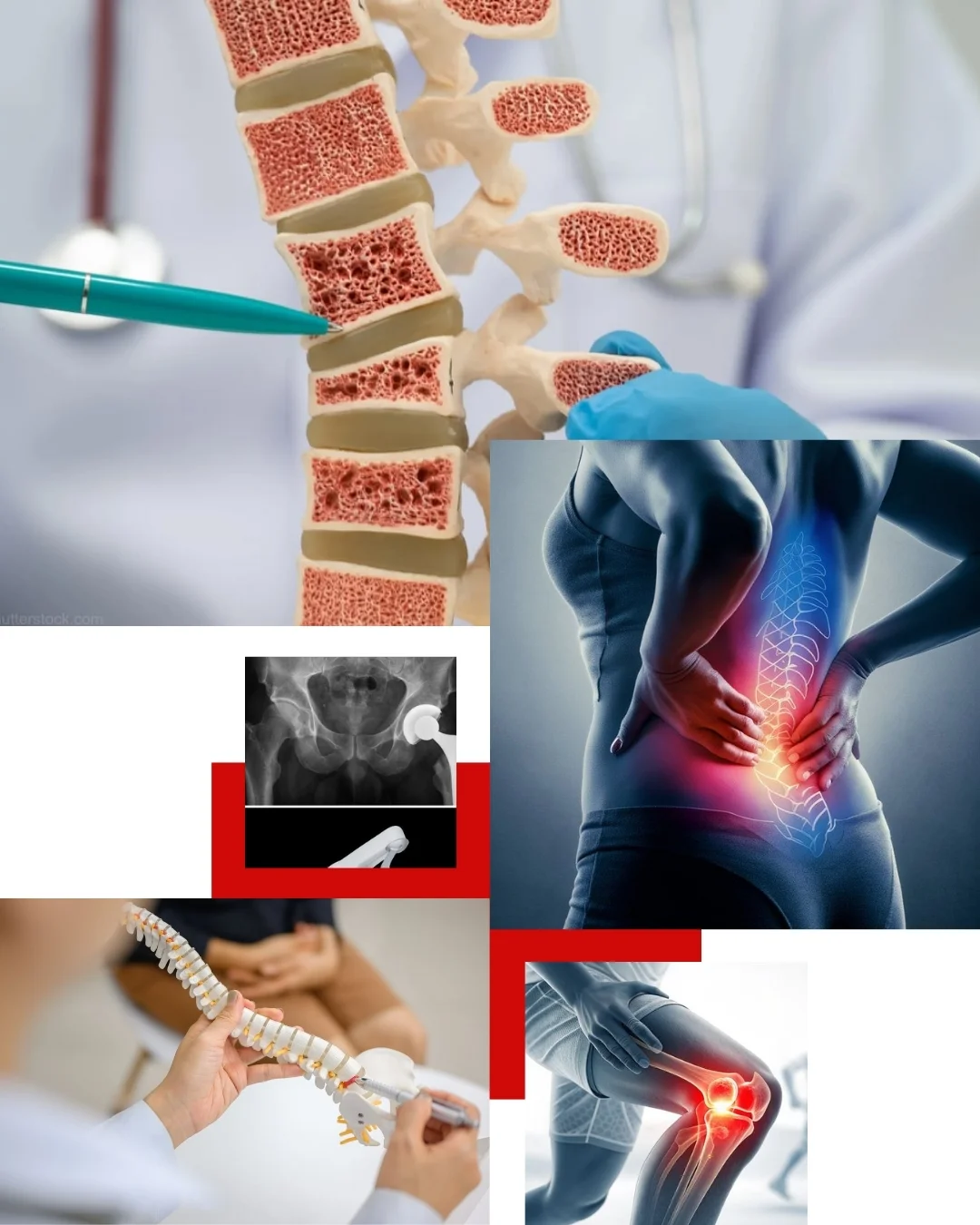 Spine Treatment & Advanced Orthopedic Procedures in Nagpur — Dr. Rahul Agrawal - RK Hospital