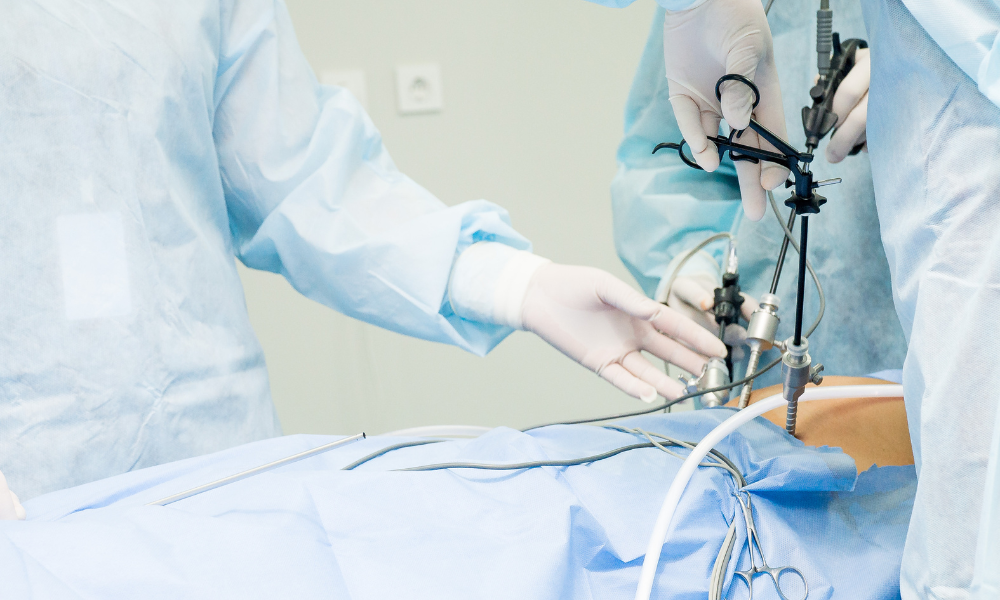 Advanced Laparoscopic Surgery in Nagpur